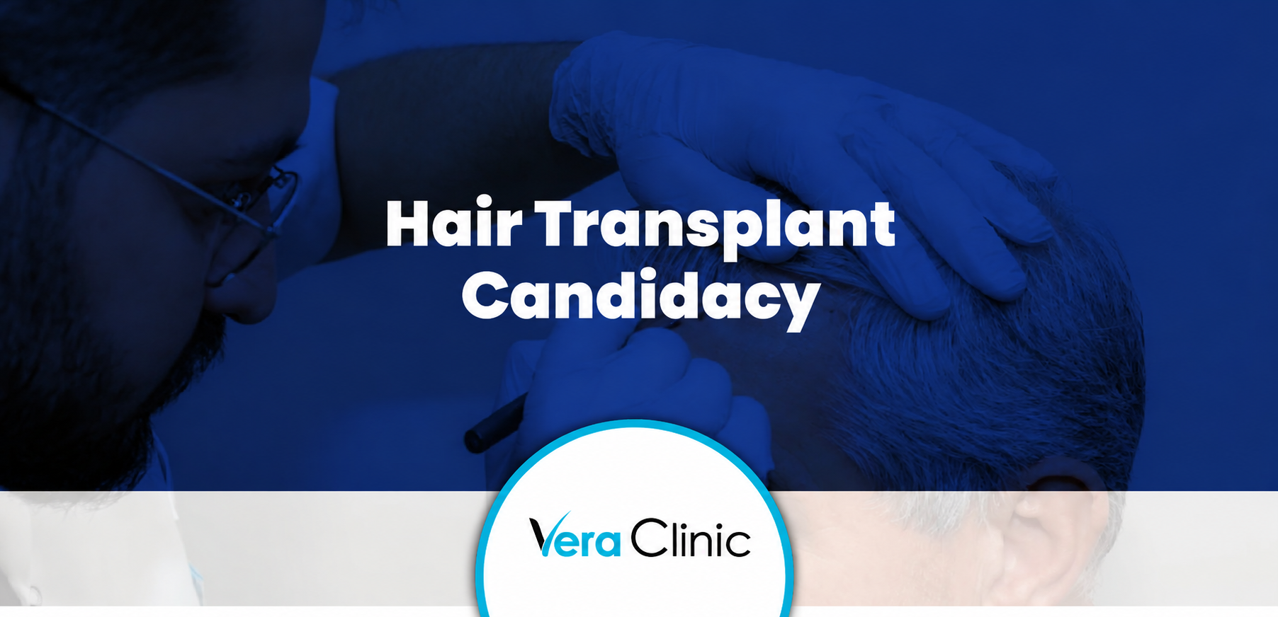 Am I a Good Candidate for a Hair Transplant? Vera Clinic
