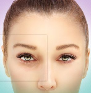 4 simple ways to get rid of eye wrinkles