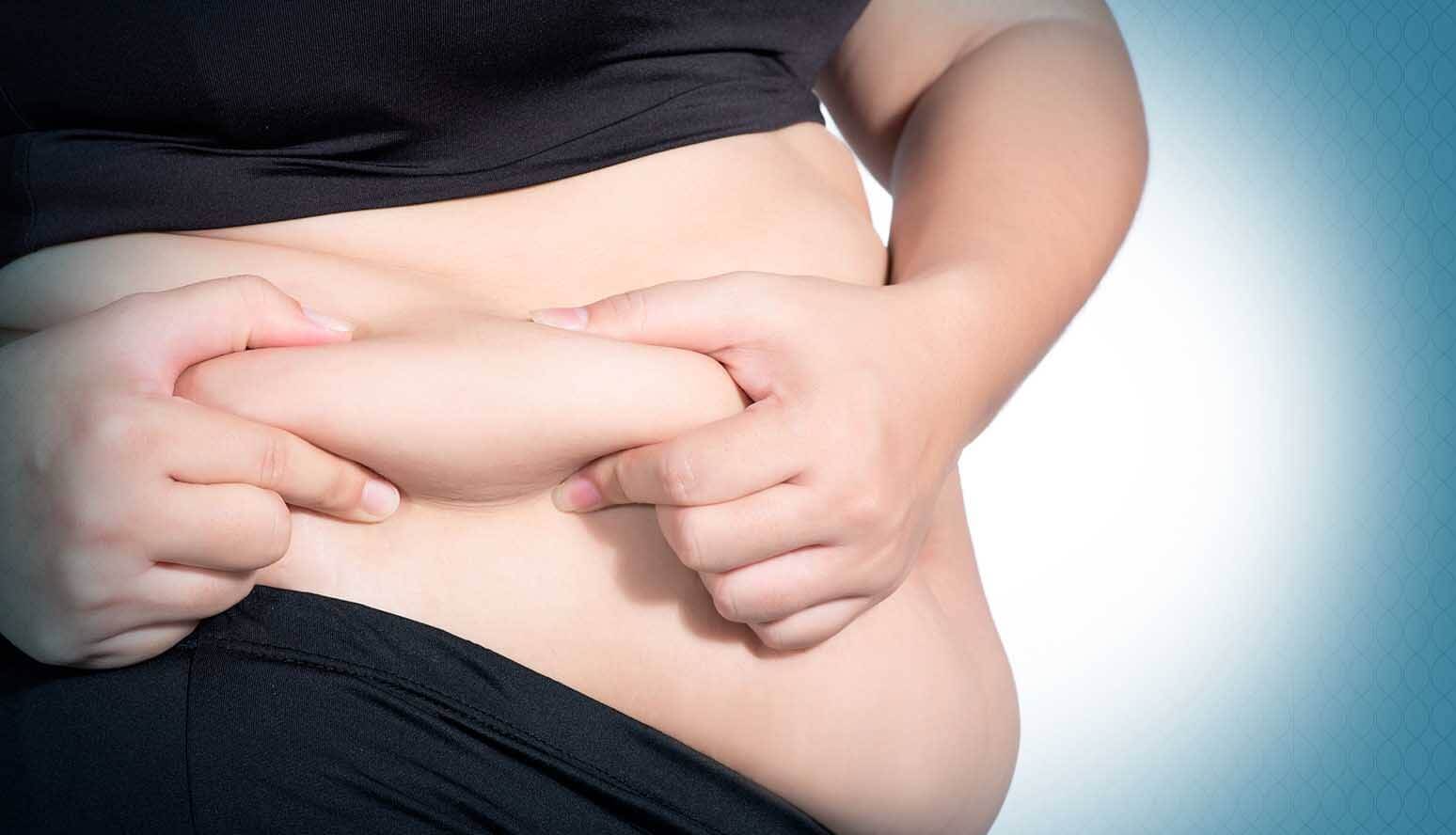 abdominal liposuction