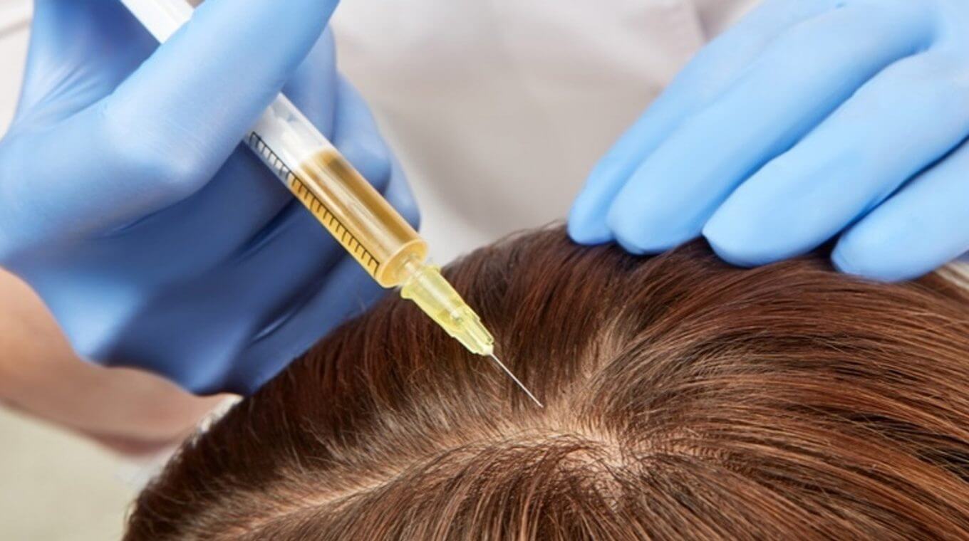 The 3 Most Effective Hair Loss Treatments and How To Use Them Vera Clinic