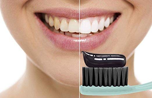 Activated charcoal for teeth whitening