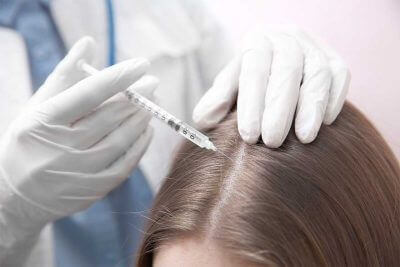  le traitement capillaire PRP cheveux