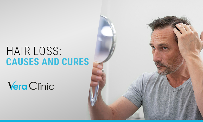 Hair Loss Causes and Cures