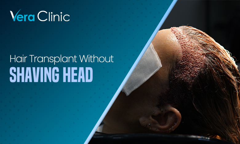 Hair Transplant Without Shaving Head
