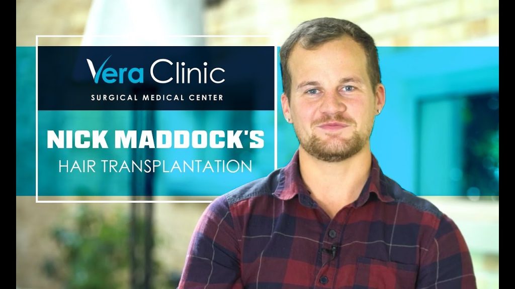 Nick Maddock hair Transplant