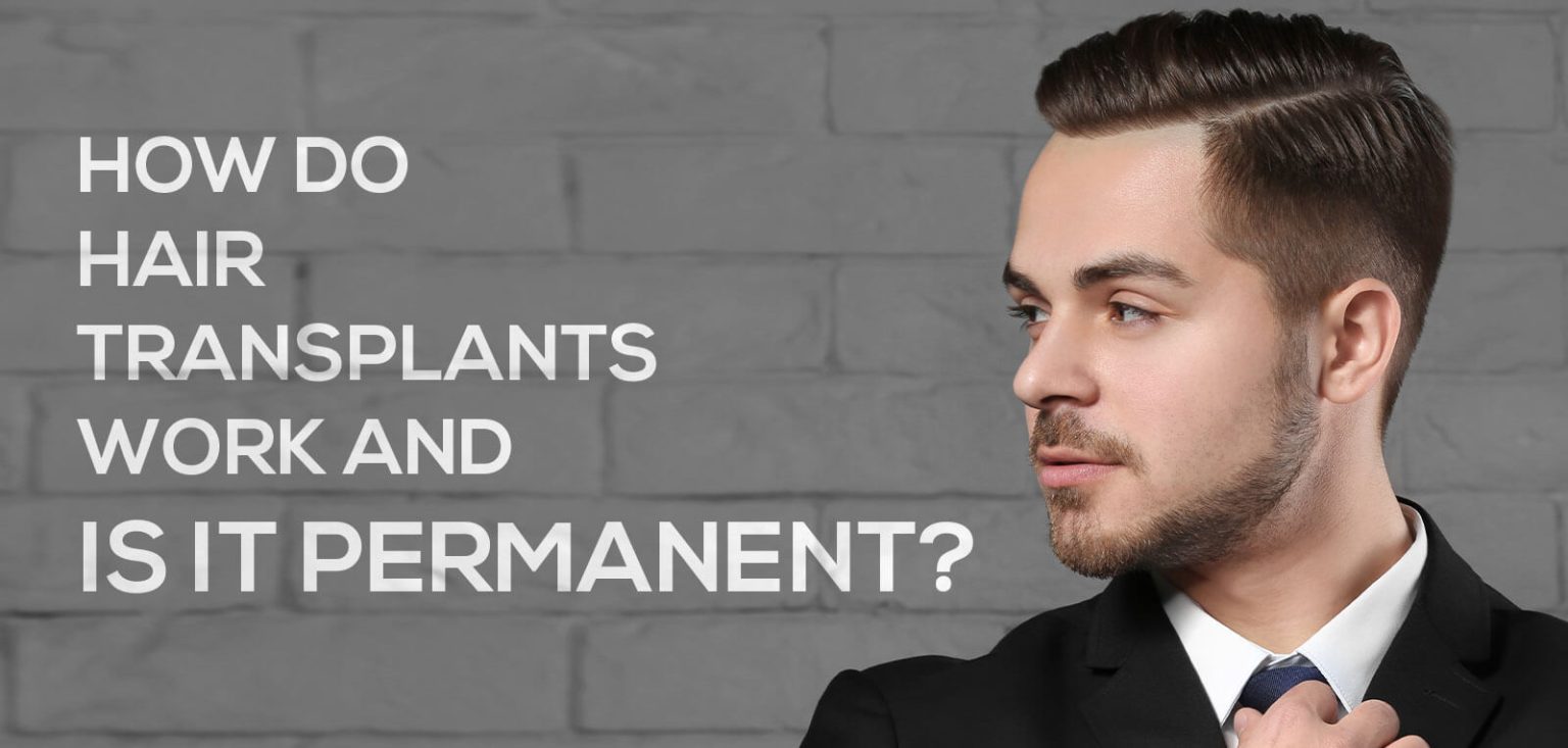 How Do Hair Transplants Work And Is It Permanent? Vera Clinic
