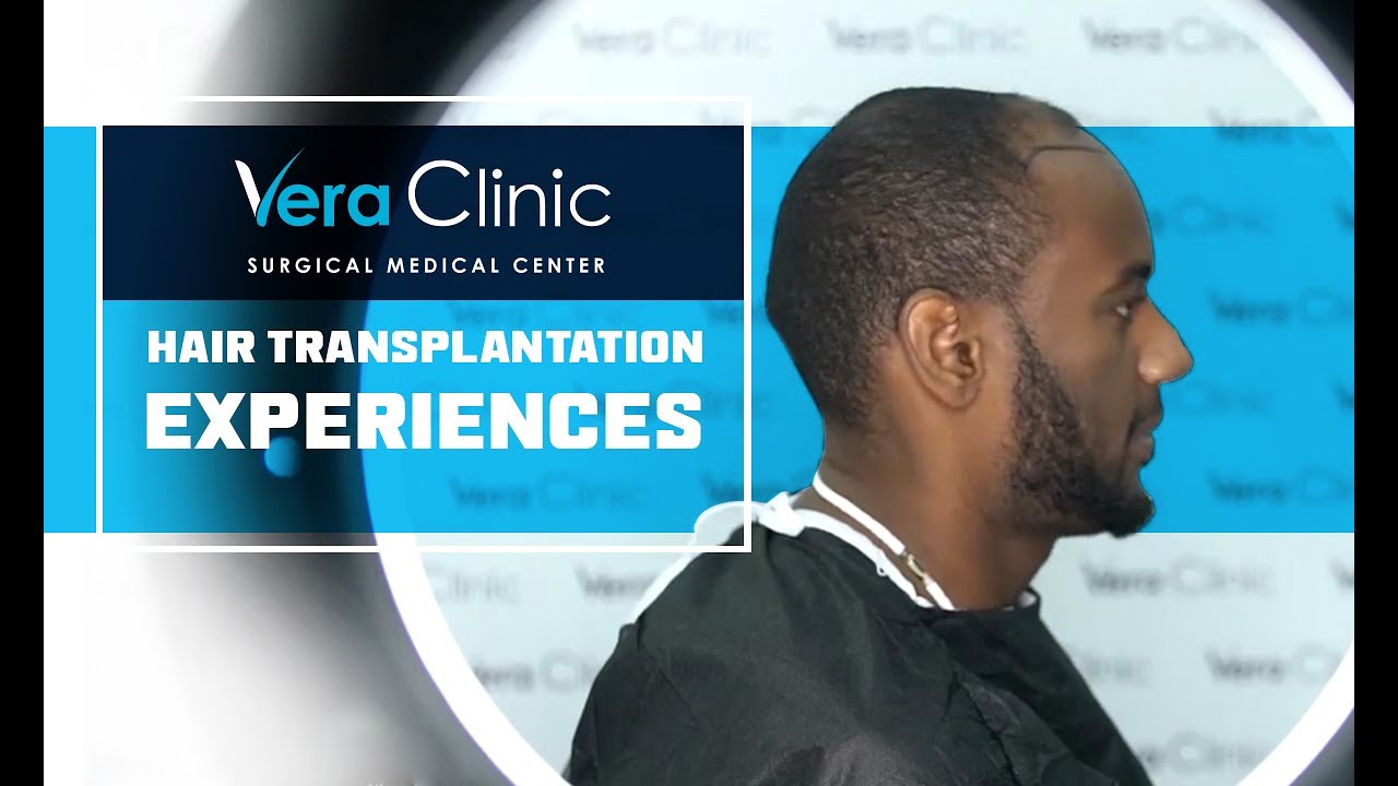Vera Clinic's Hair Transplantation Services - Vera Clinic - Vera Clinic Turkey Hair Transplant Cost
