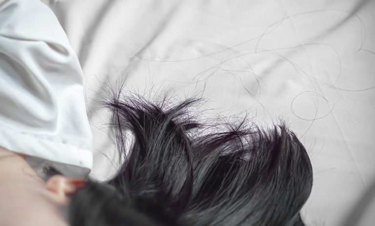 How To Prevent Hair Loss While Sleeping - Vera Clinic