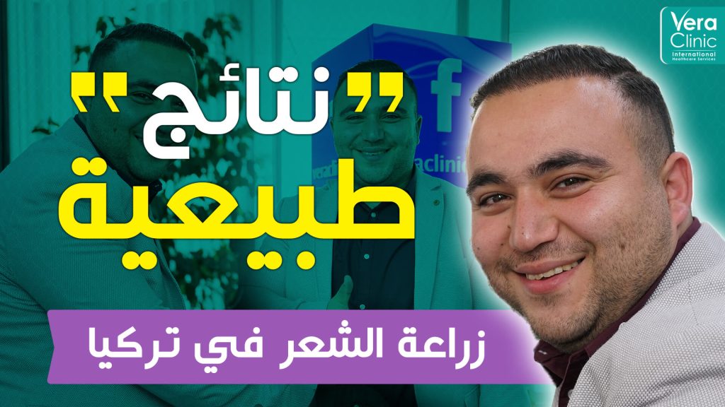 Mr. Mohammed from Jordan | Hair transplant results in Turkey