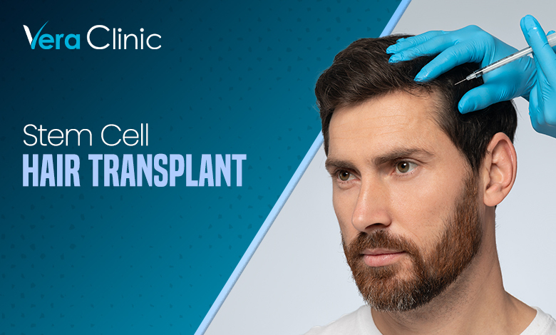 Stem Cell Hair Transplant: Revolutionizing Hair Restoration