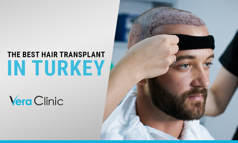 Best Hair Transplant in Turkey