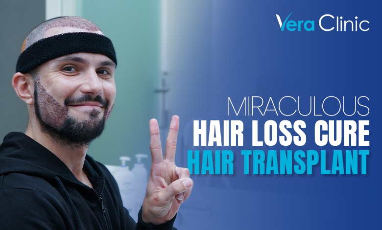 Miraculous Hair Loss Cure: Hair Transplant