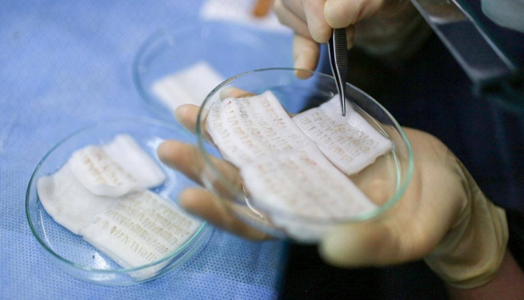 Preservation of the grafts extracted by the Hypothermosol method