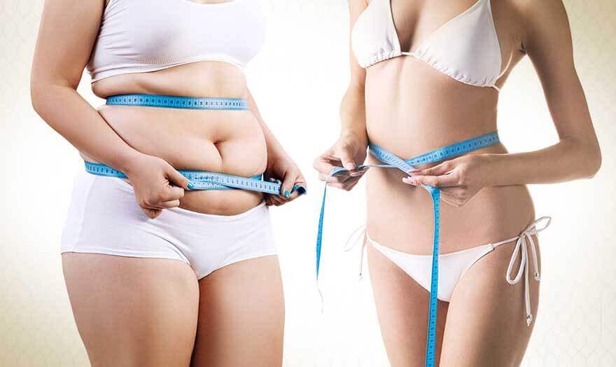 Liposuction for women