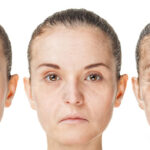 رؤى جديدة حول التغيرات المتعلقة بشيخوخة الوجه