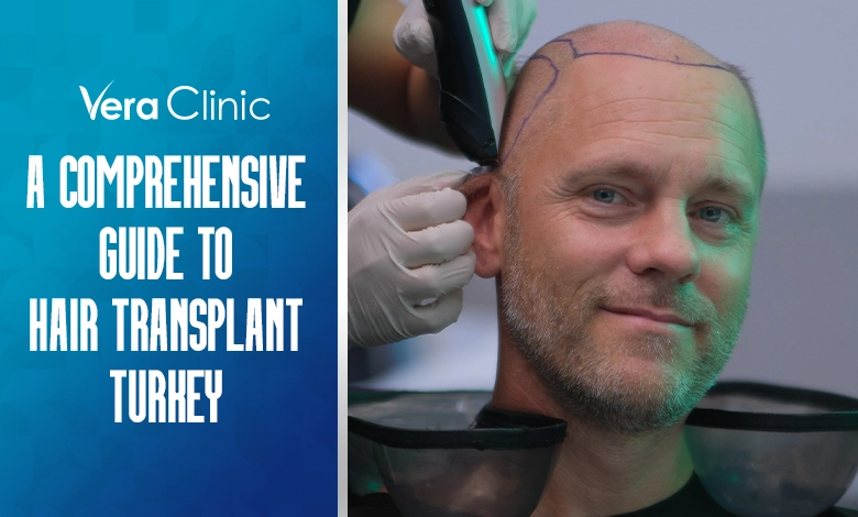 A Comprehensive Guide to Hair Transplant Turkey- All You Need to Know