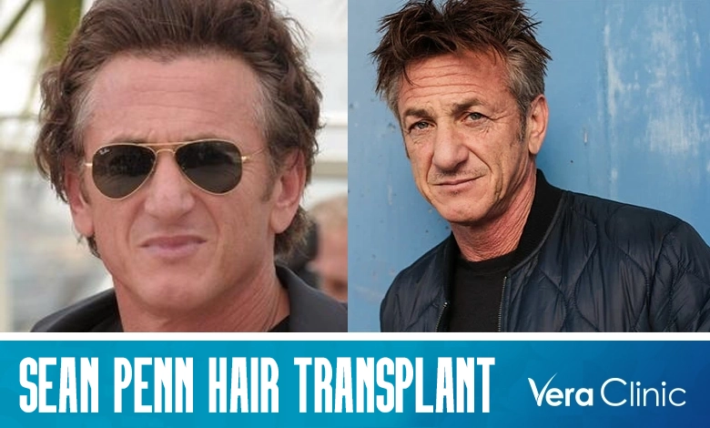 Sean Penns Hair Transplant