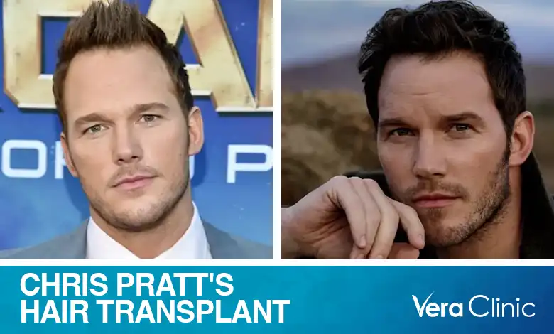 Chris Pratt Hair Transplant: Unveiling the Truth Behind Hair Transplant