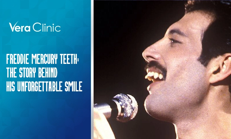 Freddie Mercury Teeth