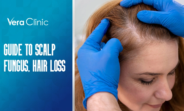 Scalp Fungus and Hair Loss