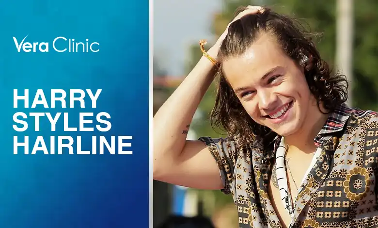 Harry Styles Hairline