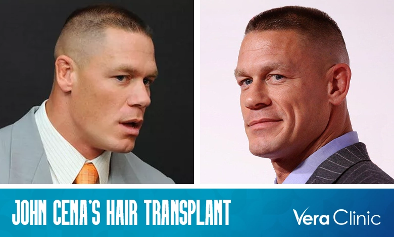 John Cena Bald Spot