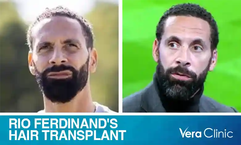 Rio Ferdinand Hair Transplant