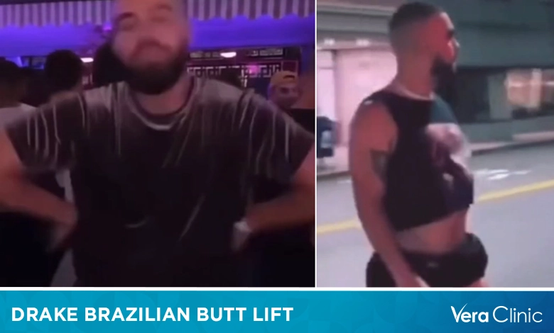 Brazilian Butt Lift Drake