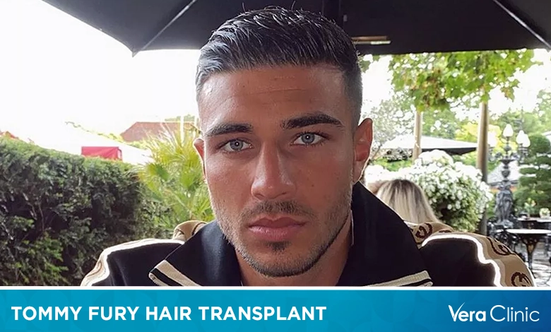 Tommy Fury Hair Transplant