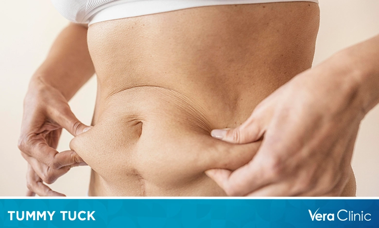How Much Does It Cost To Do A Tummy Tuck?