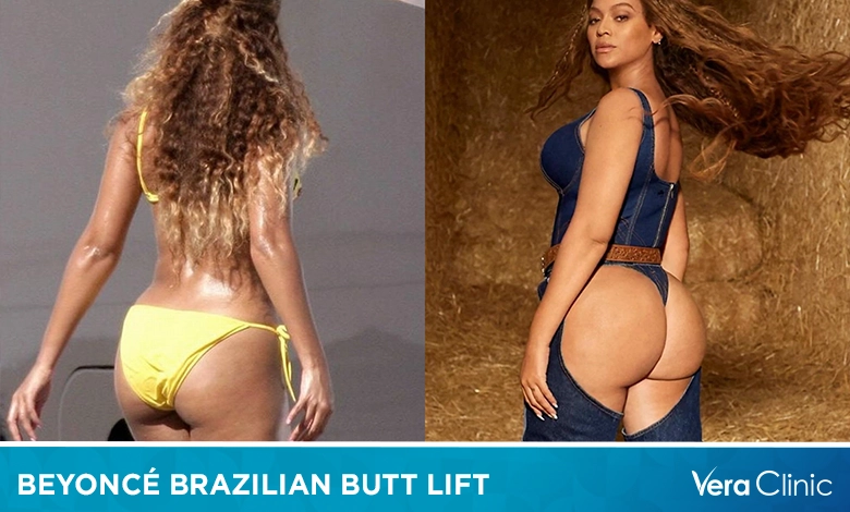 Beyoncé Brazilian Butt Lift