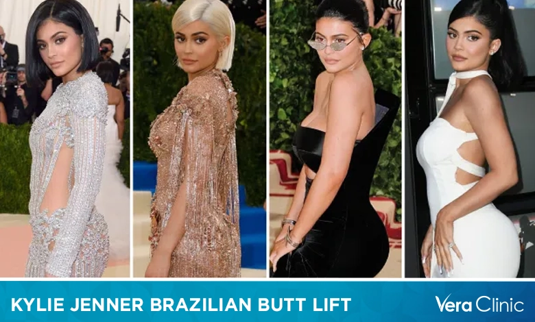 Kylie Jenner Brazilian Butt Lift