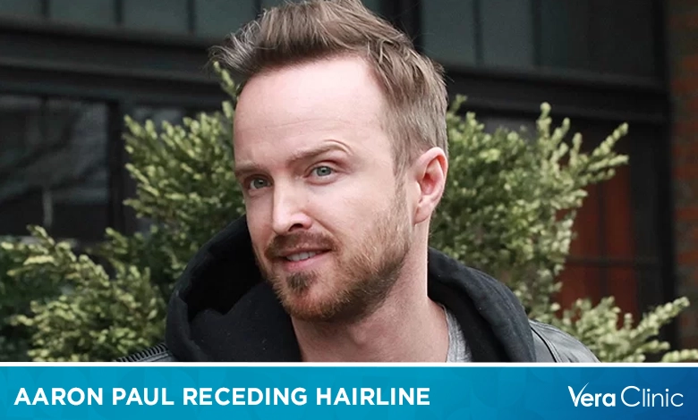 Aaron Paul Receding Hairline