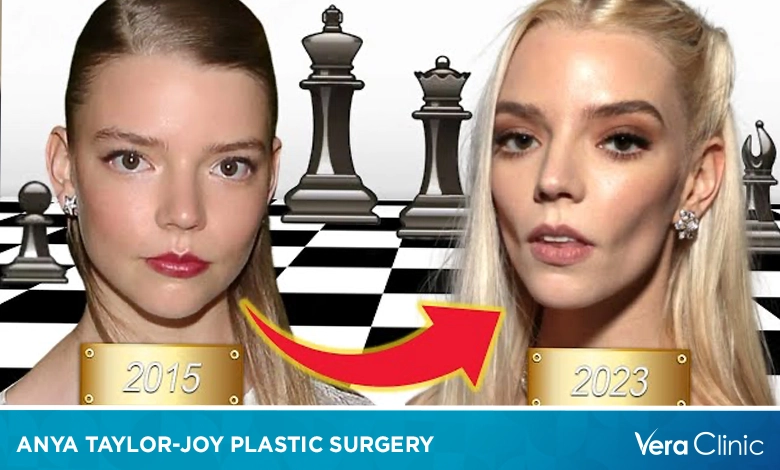 Anya-Taylor-Joy-Plastic-Surgery.webp
