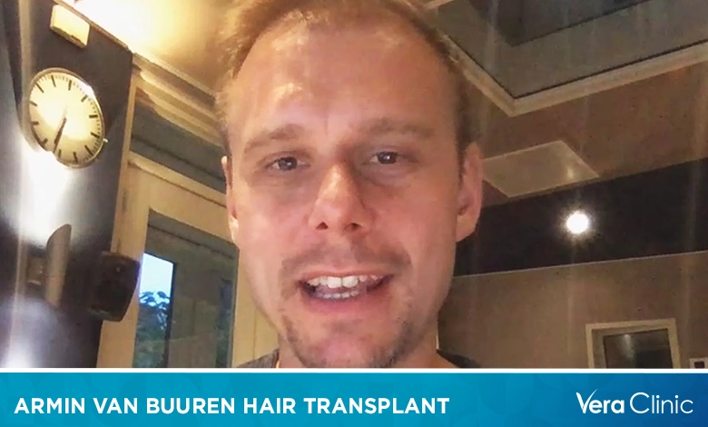 Armin van Buuren Hair Transplant