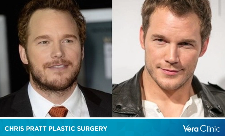 Chris Pratt Plastic Surgery