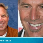 Kevin Costner Teeth