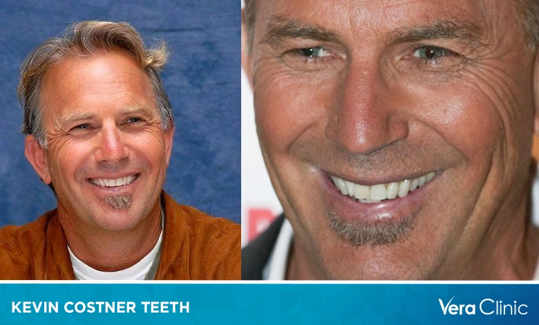 Kevin Costner Teeth