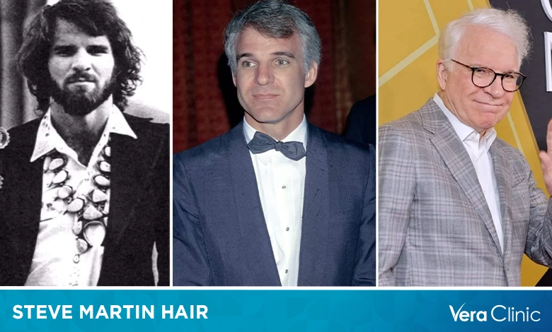 Steve Martin Hair