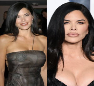 Lauren Sanchez Plastic Surgery: Facts, Rumors, and the Beauty Evolution