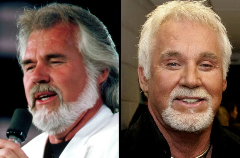 Kenny Rogers Plastic Surgery: Revealing the Change