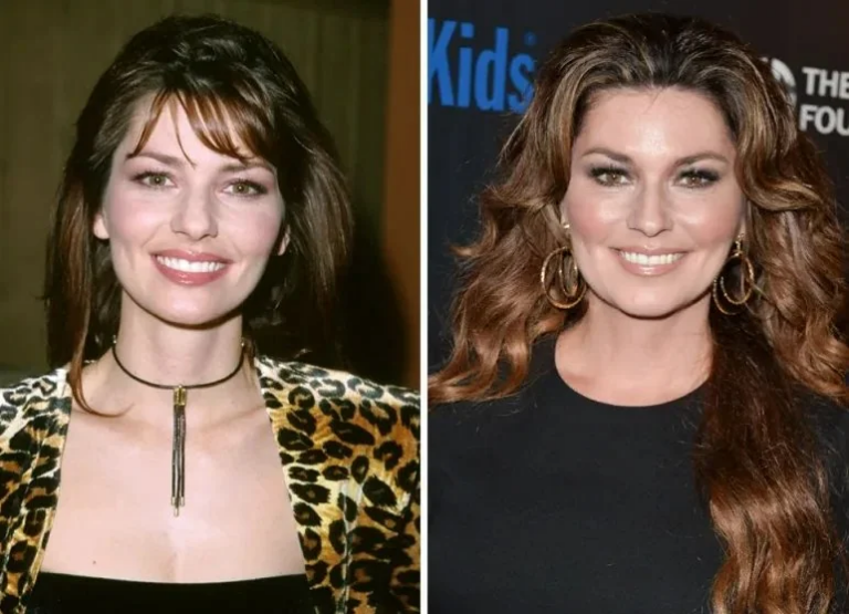 Shania Twain Plastic Surgery A Deep Dive into Her Evolving Appearance