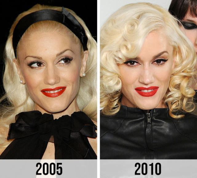 gwen-stefani-plastic-surgery-a-look-at-before-and-after