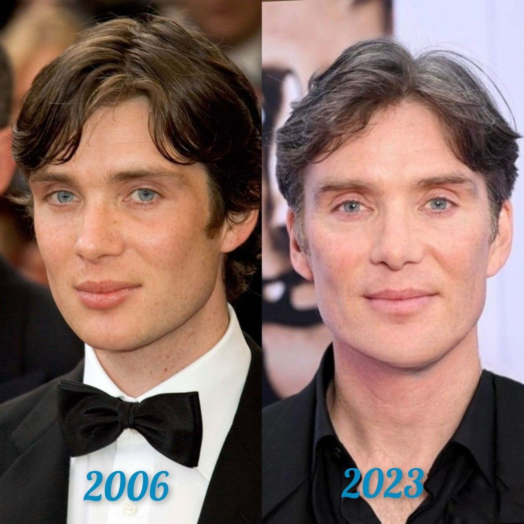 Cillian Murphy: Plastic Surgery Rumors Explored