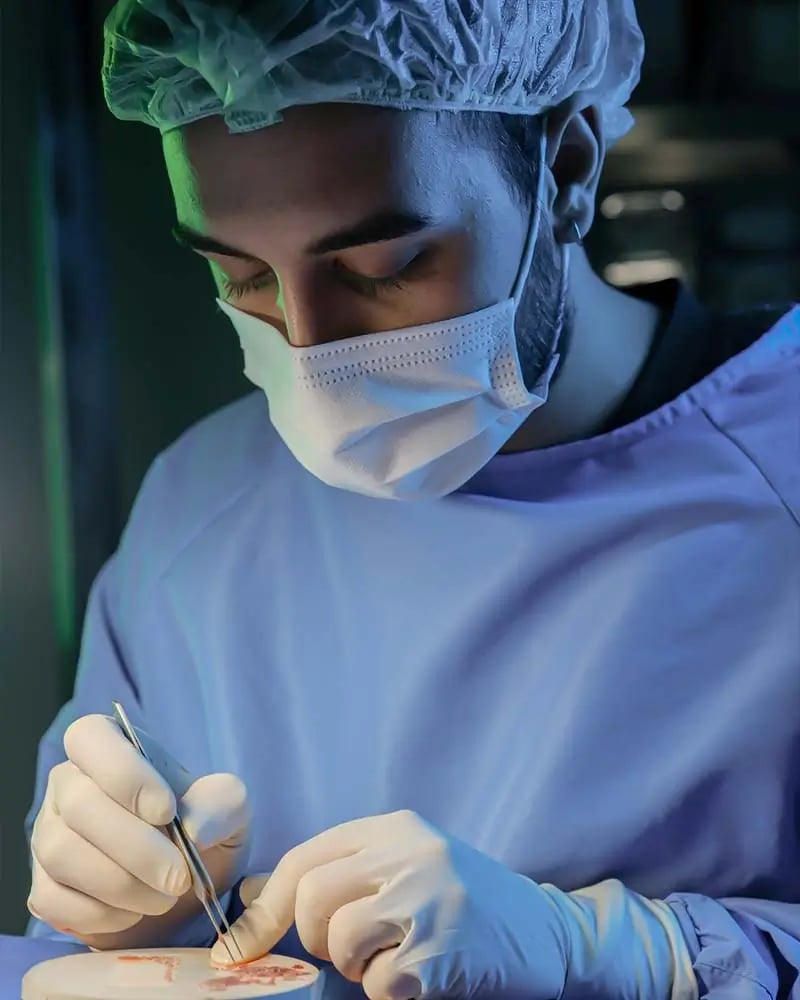 Cost of FUE Hair Transplant in Turkey