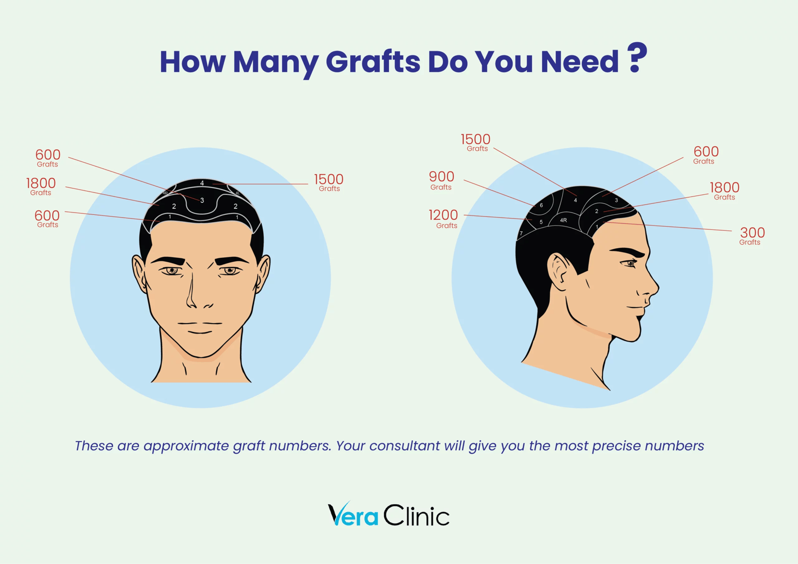 grafts