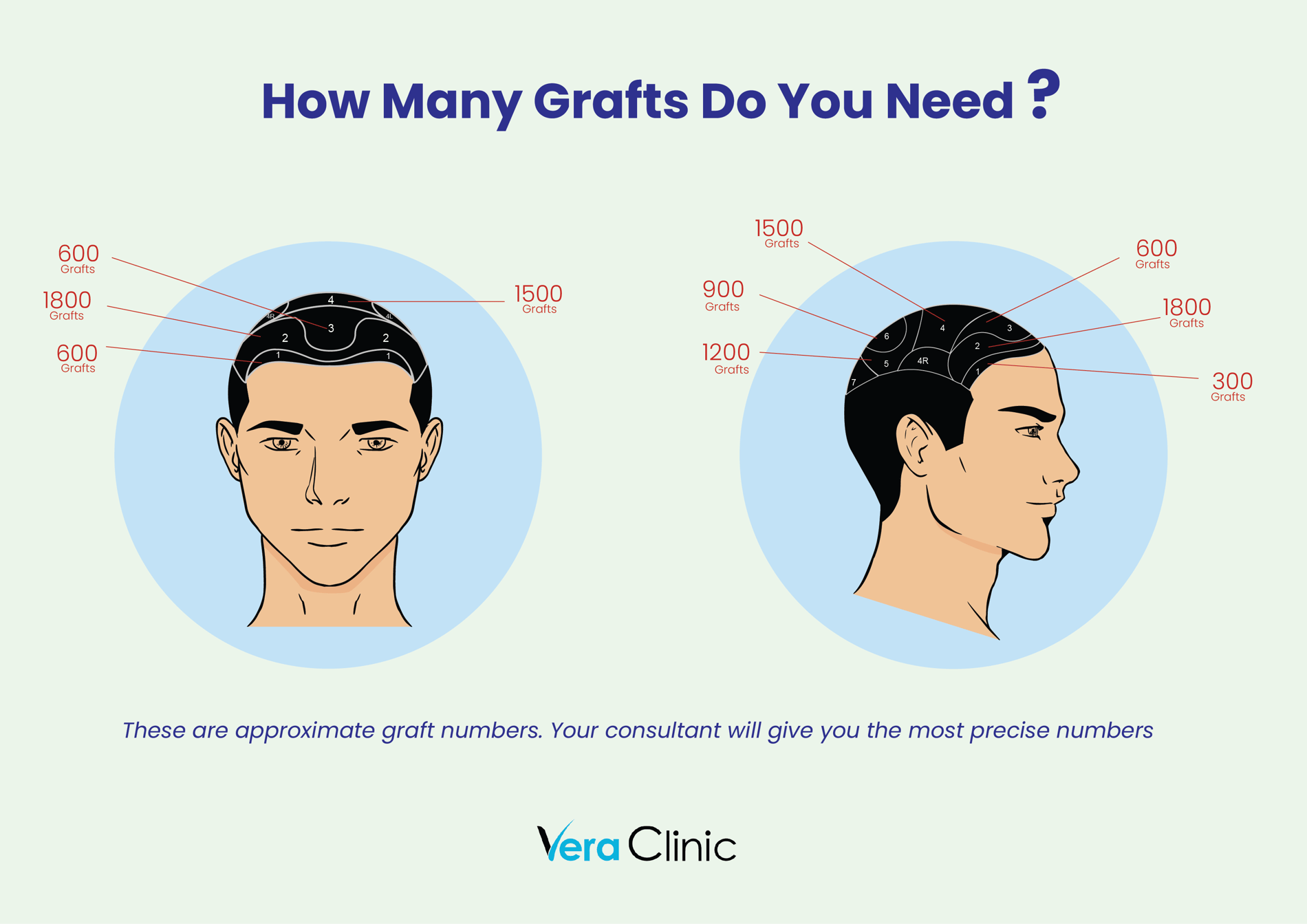 grafts