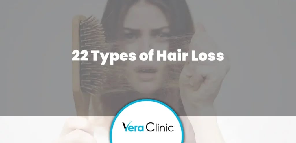 22 Types of Hair Loss