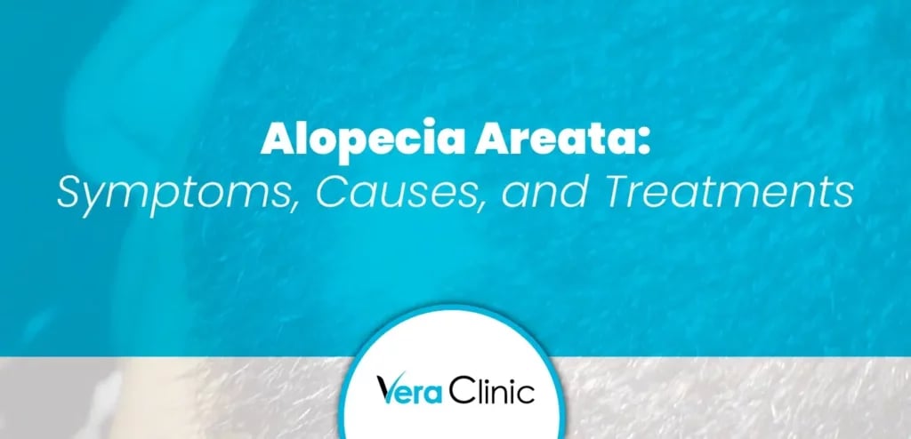 Alopecia Areata