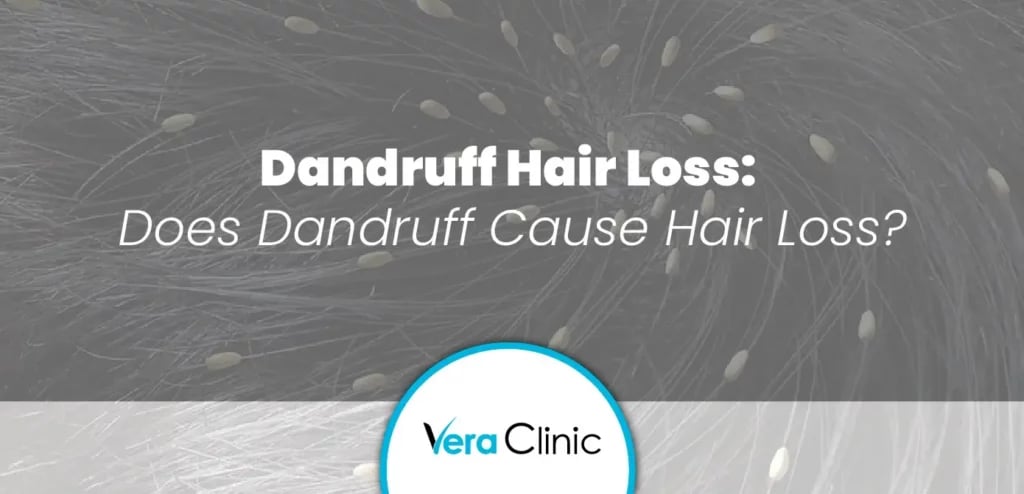 Dandruff Hair Loss